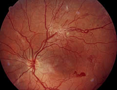 Augenarzt Uslar - Fachpraxis fr Augenheilkunde