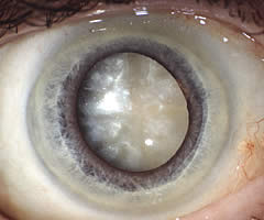 Fachpraxis fr Augenheilkunde - Augenarzt Uslar